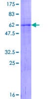 Human ADAMTS4 Protein (Recombinant GST)