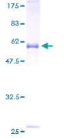 Human GDF15 Protein (Recombinant GST)