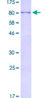 Human MSLN / Mesothelin Protein (Recombinant GST)