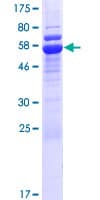Human STUB1 / CHIP Protein (Recombinant GST)
