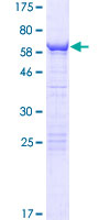 Human CWC27 Protein (Recombinant GST)