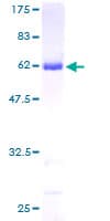 Human AKR1A1 Protein (Recombinant GST)