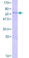 Human PRPF8 Protein (Recombinant GST)