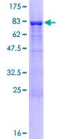 Human NUP50 Protein (Recombinant GST)