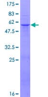 Human Chymotrypsin C Protein (Recombinant GST)