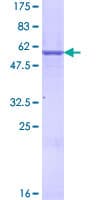 Human Prohibitin 2 / PHB2 Protein (Recombinant GST)