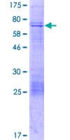 Human KLHDC10 Protein (Recombinant GST)