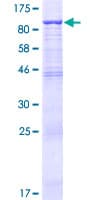 Human FBXO21 Protein (Recombinant GST)