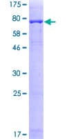 Human PRAME Protein (Recombinant GST)