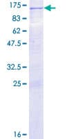 Human PRKD2 / PKD2 Protein (Recombinant GST)