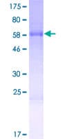 Human TFPT / Amida Protein (Recombinant GST)