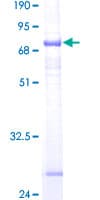 Human ST6GALNAC6 Protein (Recombinant GST)