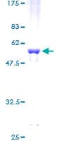 Human CMPK / CMPK1 Protein (Recombinant GST)