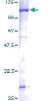 Human STRBP / SPNR Protein (Recombinant GST)