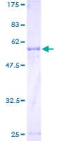 Human UGGT2 Protein (Recombinant GST)