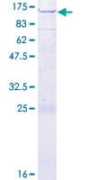 Human SNX14 Protein (Recombinant GST)
