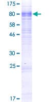 Human SLC13A3 Protein (Recombinant GST)