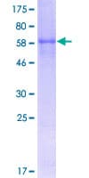 Human CDCP1 Protein (Recombinant GST)