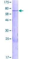 Human WBSCR16 Protein (Recombinant GST)