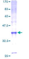 Human SLC10A7 Protein (Recombinant GST)