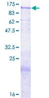 Human SGIP1 Protein (Recombinant GST)