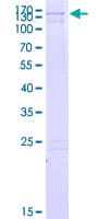 Human ACRC Protein (Recombinant GST)