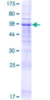 Human MBOAT2 Protein (Recombinant GST)