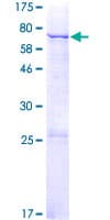 Human MGAT5B Protein (Recombinant GST)