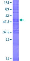 Human OR6C75 Protein (Recombinant GST)