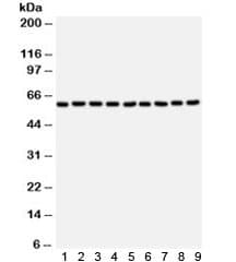 Polyclonal Rabbit anti-Human SMAD4 Antibody (WB)