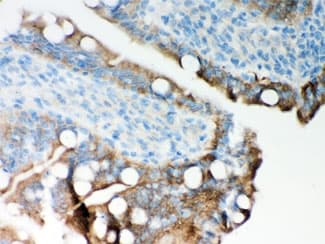 ITPR3 Antibody