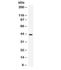 Polyclonal Rabbit anti-Human B3GNT8 Antibody (IHC, WB)