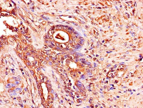 ADAM12 Antibody