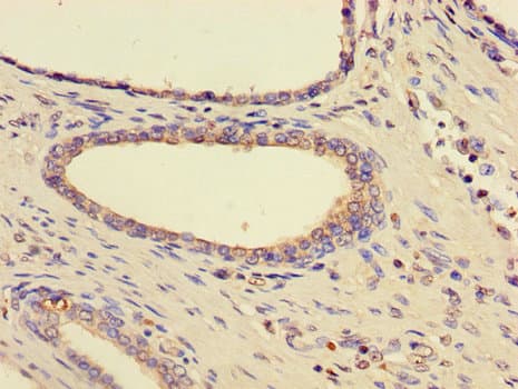 Polyclonal Rabbit anti-Human HSPA9 / Mortalin / GRP75 Antibody (IHC)