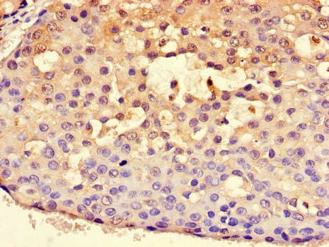 Polyclonal Rabbit anti-Human HSPA9 / Mortalin / GRP75 Antibody (IHC)