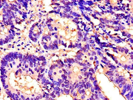 Polyclonal Rabbit anti-Human ITGAM / CD11b Antibody (IHC, IF)