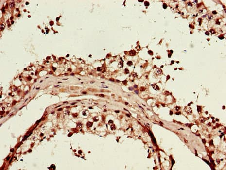 Polyclonal Rabbit anti-Human ITGAM / CD11b Antibody (IHC, IF)