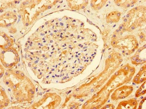 TTI1 Antibody