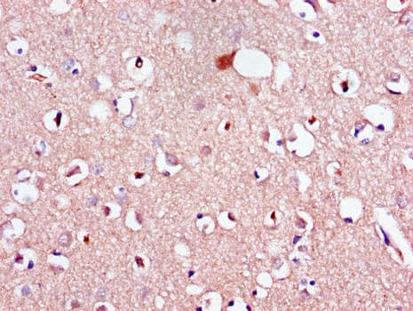 Polyclonal Rabbit anti-Human LPAR1 / LPA1 / EDG2 Antibody (IHC, IF)