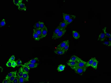 Polyclonal Rabbit anti-Human LPAR1 / LPA1 / EDG2 Antibody (IHC, IF)