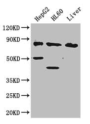 Polyclonal Rabbit anti-Human PFKL Antibody (IHC, IF, WB)