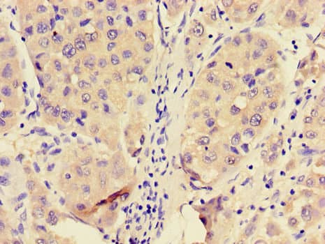 Polyclonal Rabbit anti-Human PFKL Antibody (IHC, IF, WB)