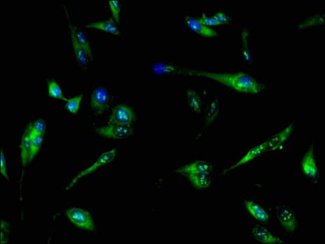 Polyclonal Rabbit anti-Human PFKL Antibody (IHC, IF, WB)
