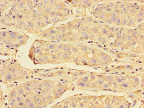 Polyclonal Rabbit anti-Human PRDX3 / Peroxiredoxin 3 Antibody (IHC, IF, WB)