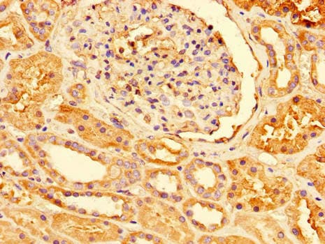 Polyclonal Rabbit anti-Human PRDX3 / Peroxiredoxin 3 Antibody (IHC, IF, WB)