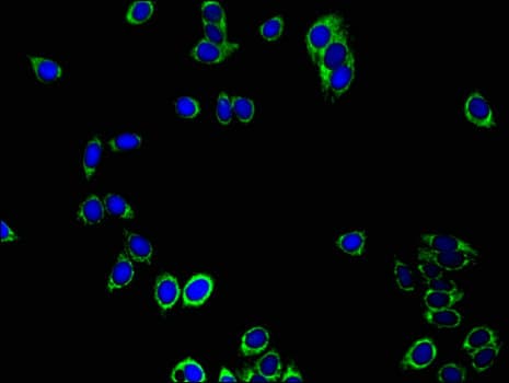Polyclonal Rabbit anti-Human PRDX3 / Peroxiredoxin 3 Antibody (IHC, IF, WB)