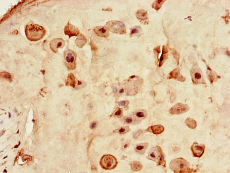 Polyclonal Rabbit anti-Human RXRG Antibody (IHC)