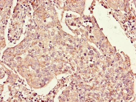Polyclonal Rabbit anti-Human RXRG Antibody (IHC)
