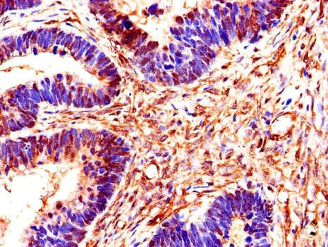 Polyclonal Rabbit anti-Human SMS / Spermine Synthase Antibody (IHC, IF)