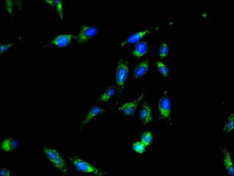 Polyclonal Rabbit anti-Human SMS / Spermine Synthase Antibody (IHC, IF)